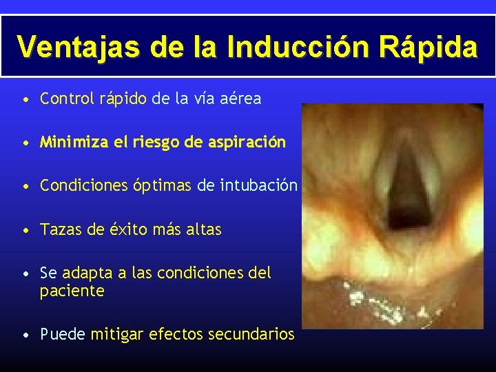 Ventajas de la Inducción Rápida • Control rápido de la vía aérea • Minimiza