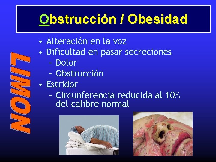 Obstrucción / Obesidad • Alteración en la voz • Dificultad en pasar secreciones –