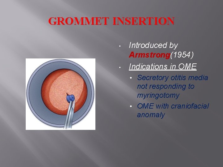 GROMMET INSERTION • • Introduced by Armstrong(1954) Indications in OME Secretory otitis media not