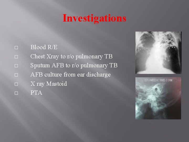 Investigations � � � Blood R/E Chest Xray to r/o pulmonary TB Sputum AFB