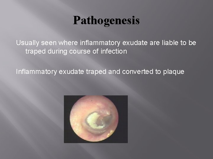 Pathogenesis Usually seen where inflammatory exudate are liable to be traped during course of Pathogenesis Usually seen where inflammatory exudate are liable to be traped during course of
