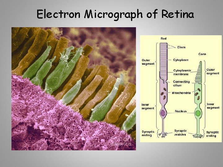 Electron Micrograph of Retina 