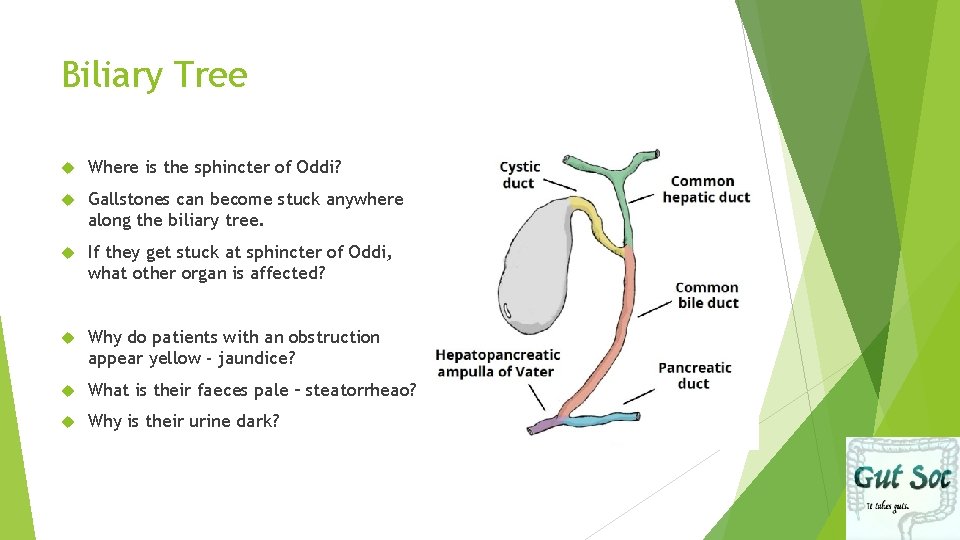 Biliary Tree Where is the sphincter of Oddi? Gallstones can become stuck anywhere along