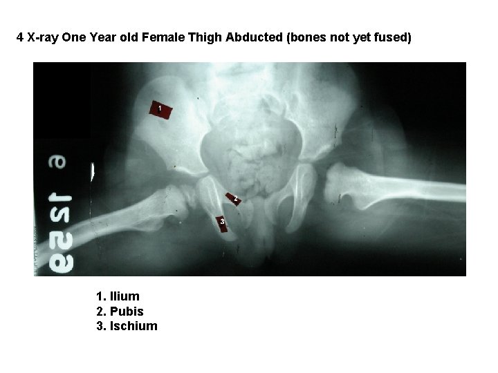 4 X-ray One Year old Female Thigh Abducted (bones not yet fused) 1. Ilium
