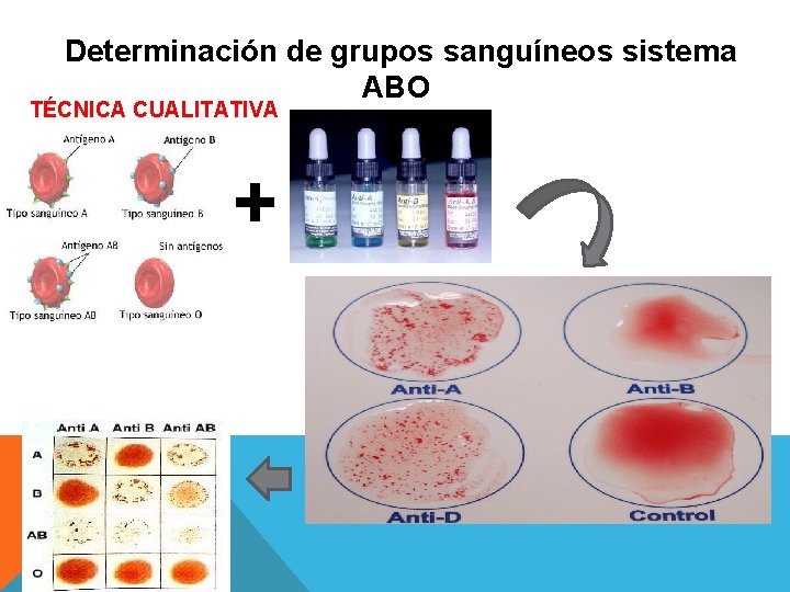  Determinación de grupos sanguíneos sistema ABO TÉCNICA CUALITATIVA + 