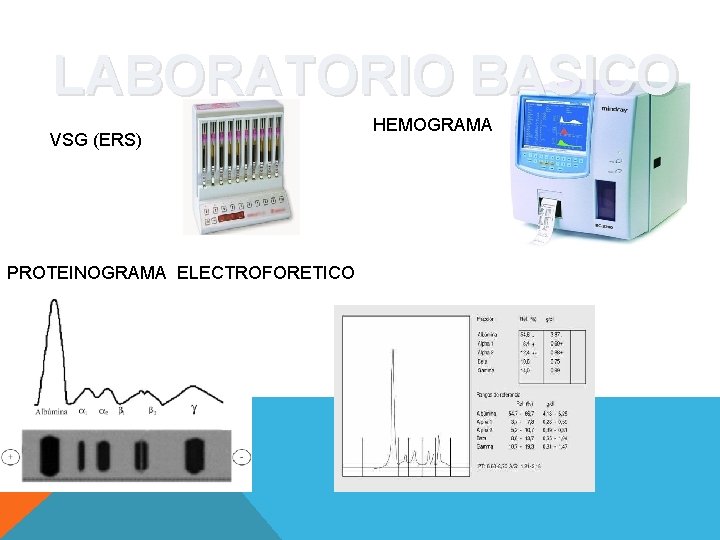 LABORATORIO BASICO VSG (ERS) PROTEINOGRAMA ELECTROFORETICO HEMOGRAMA 
