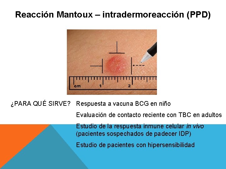 Reacción Mantoux – intradermoreacción (PPD) ¿PARA QUÉ SIRVE? Respuesta a vacuna BCG en niño