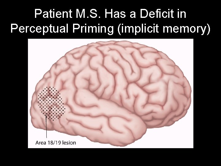 Patient M. S. Has a Deficit in Perceptual Priming (implicit memory) 