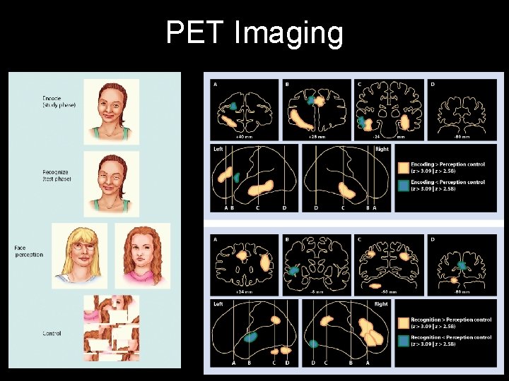 PET Imaging 