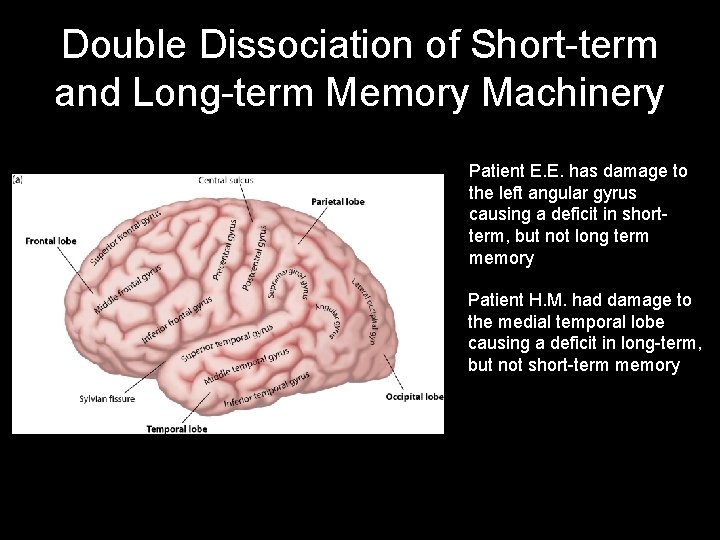 Double Dissociation of Short-term and Long-term Memory Machinery Patient E. E. has damage to