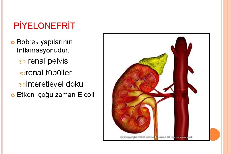 PİYELONEFRİT Böbrek yapılarının Inflamasyonudur: renal pelvis renal tübüller İnterstisyel doku Etken çoğu zaman E.