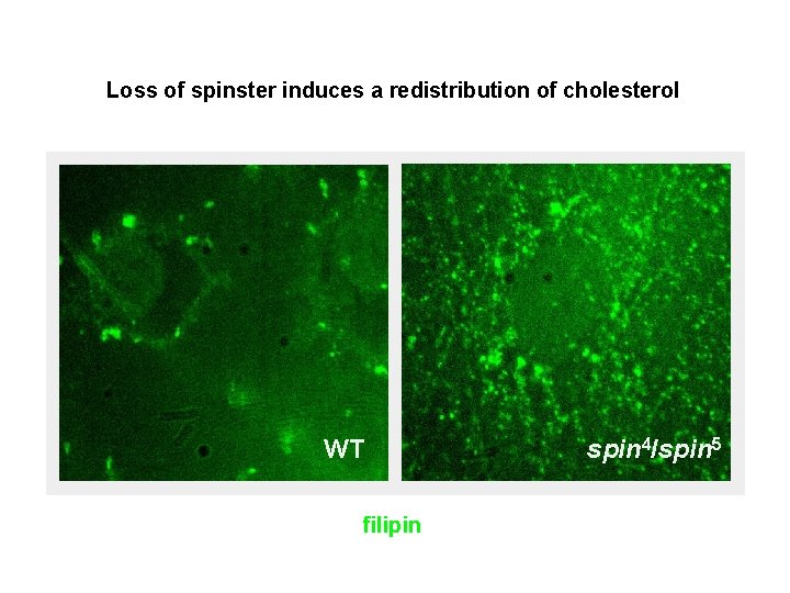 Loss of spinster induces a redistribution of cholesterol WT filipin spin 4/spin 5 