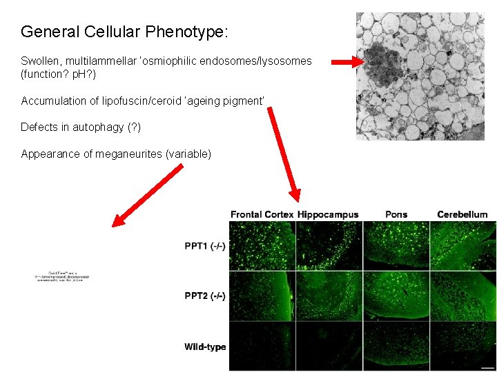 General Cellular Phenotype: Swollen, multilammellar ‘osmiophilic endosomes/lysosomes (function? p. H? ) Accumulation of lipofuscin/ceroid