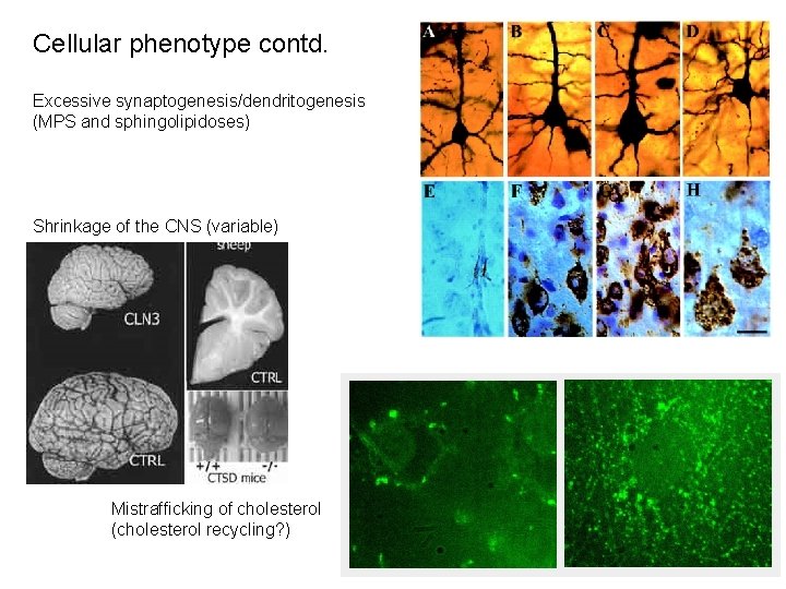 Cellular phenotype contd. Excessive synaptogenesis/dendritogenesis (MPS and sphingolipidoses) Shrinkage of the CNS (variable) Mistrafficking