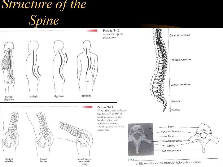 Structure of the Spine 