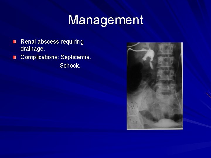 Management Renal abscess requiring drainage. Complications: Septicemia. Schock. 