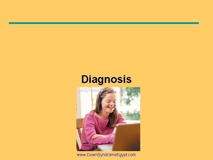 Diagnosis www. Down. Syndrome. Egypt. com Diagnosis www. Down. Syndrome. Egypt. com