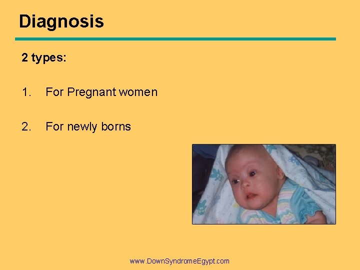 Diagnosis 2 types: 1. For Pregnant women 2. For newly borns www. Down. Syndrome.