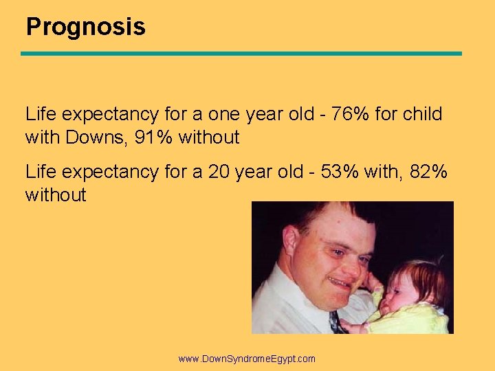 Prognosis Life expectancy for a one year old - 76% for child with Downs,