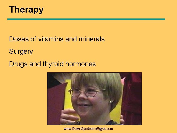 Therapy Doses of vitamins and minerals Surgery Drugs and thyroid hormones www. Down. Syndrome.