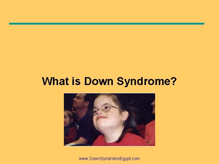 What is Down Syndrome? www. Down. Syndrome. Egypt. com 