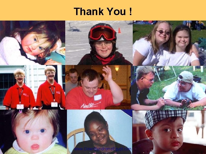Thank You ! www. Down. Syndrome. Egypt. com Thank You ! www. Down. Syndrome. Egypt. com