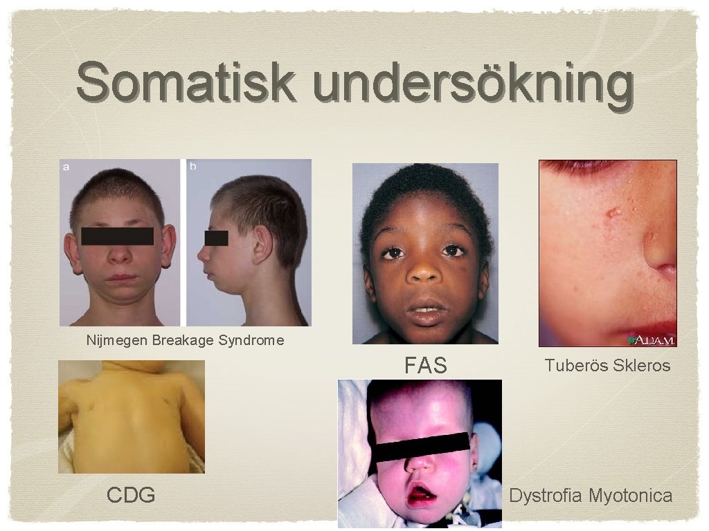 Somatisk undersökning Nijmegen Breakage Syndrome FAS CDG Tuberös Skleros Dystrofia Myotonica 