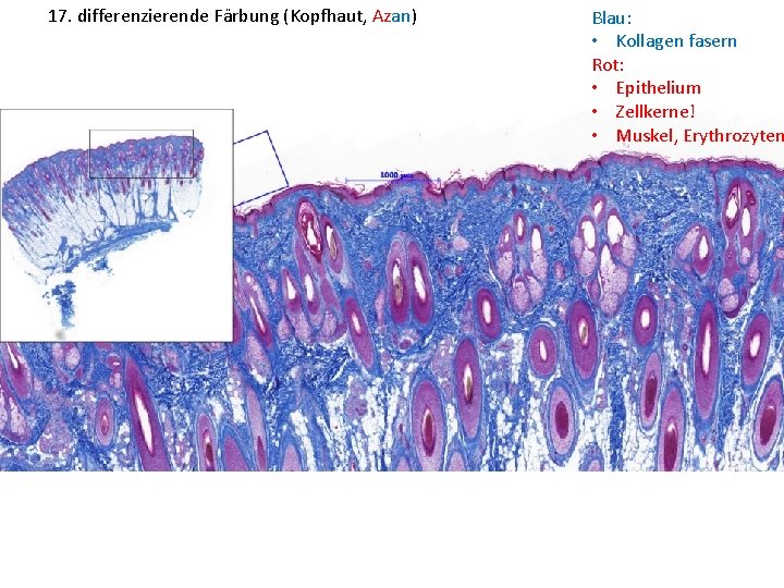 17. differenzierende Färbung (Kopfhaut, Azan) Blau: • Kollagen fasern Rot: • Epithelium • Zellkerne!