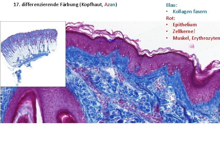 17. differenzierende Färbung (Kopfhaut, Azan) Blau: • Kollagen fasern Rot: • Epithelium • Zellkerne!