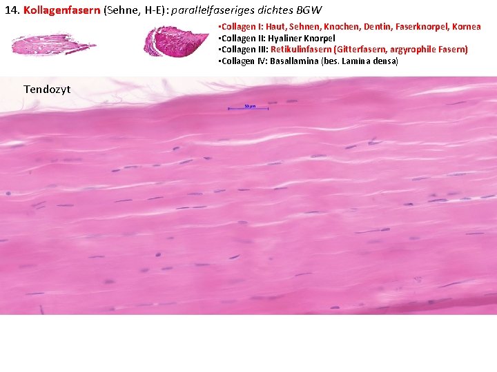 14. Kollagenfasern (Sehne, H-E): parallelfaseriges dichtes BGW • Collagen I: Haut, Sehnen, Knochen, Dentin,