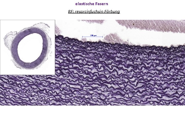 elastische Fasern RF: resorcinfuchsin Färbung 