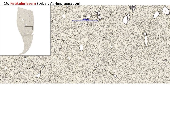 16. Retikulinfasern (Leber, Ag-Imprägnation) 