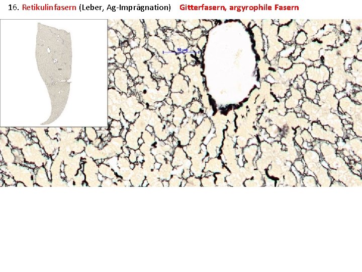 16. Retikulinfasern (Leber, Ag-Imprägnation) Gitterfasern, argyrophile Fasern 