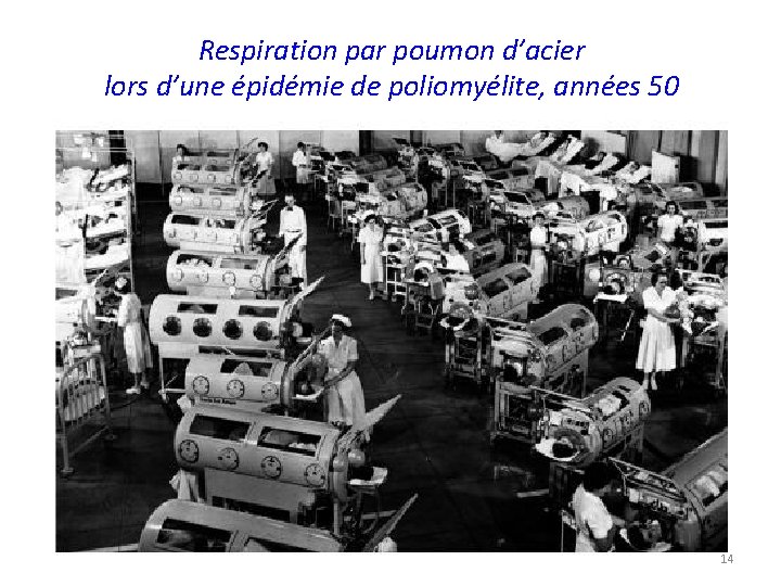 Respiration par poumon d’acier lors d’une épidémie de poliomyélite, années 50 14 