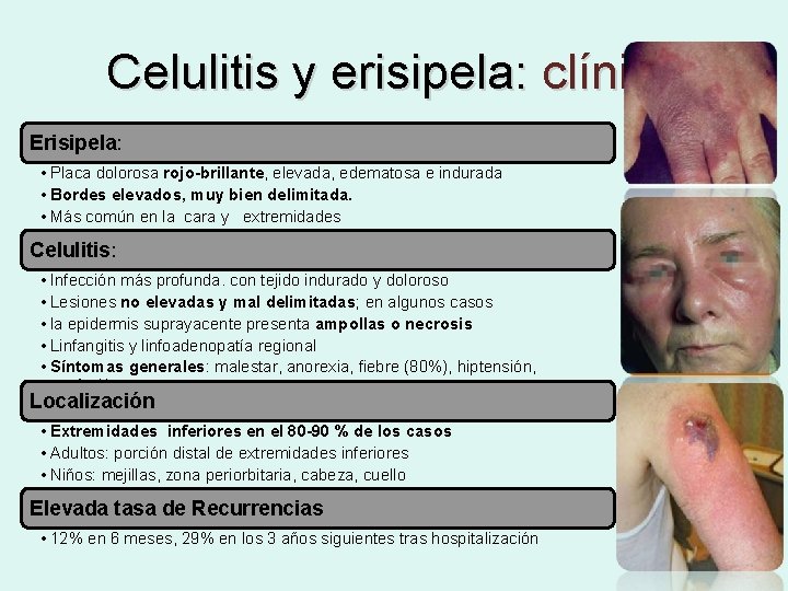 Celulitis y erisipela: clínica Erisipela: • Placa dolorosa rojo-brillante, elevada, edematosa e indurada •