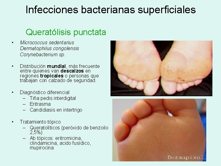 Infecciones bacterianas superficiales Queratólisis punctata • • Micrococcus sedentarius Dermatophilus congolensis Corynebacterium sp. Distribución