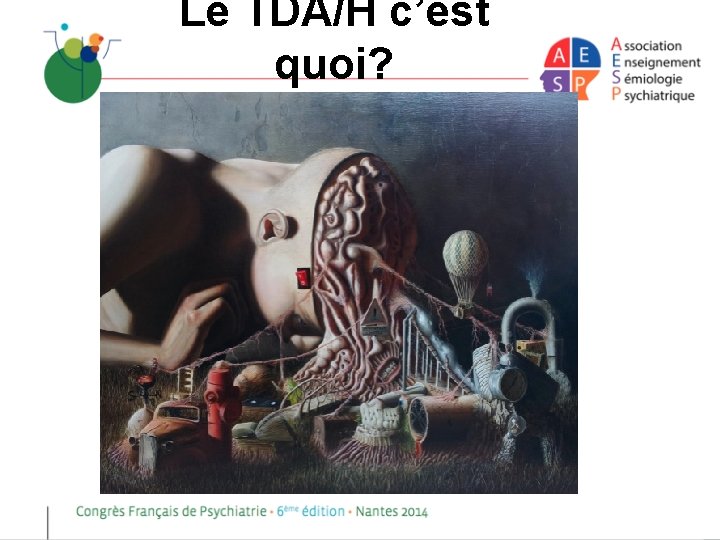 Le TDA/H c’est quoi? 