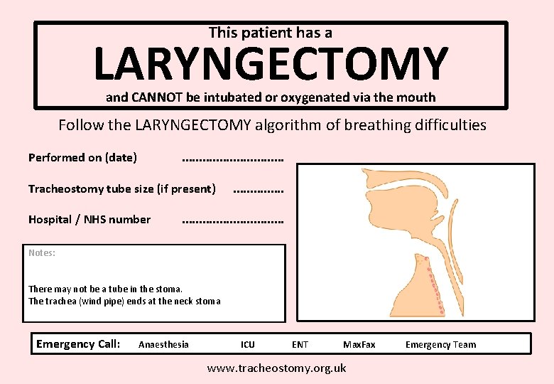 This patient has a LARYNGECTOMY and CANNOT be intubated or oxygenated via the mouth