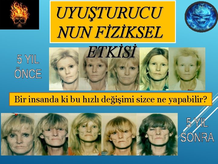 UYUŞTURUCU NUN FİZİKSEL ETKİSİ Bir insanda ki bu hızlı değişimi sizce ne yapabilir? 