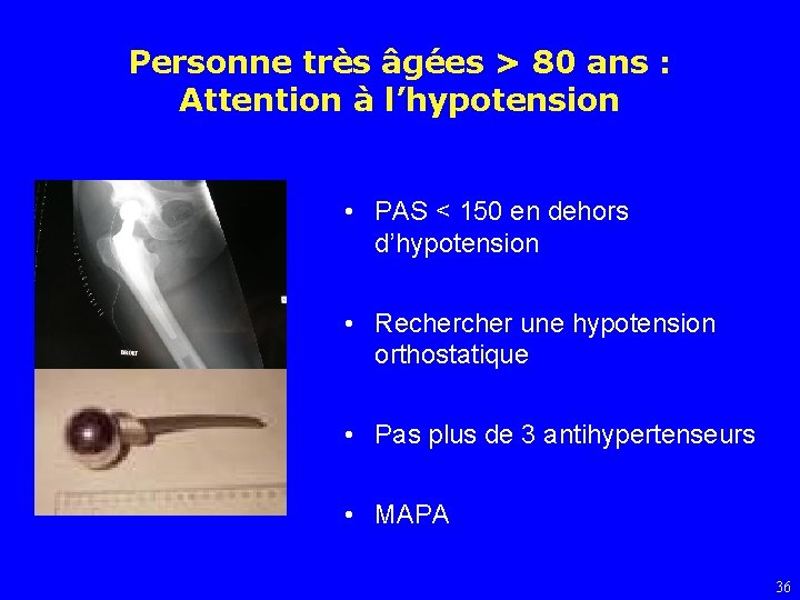 Personne très âgées > 80 ans : Attention à l’hypotension • PAS < 150