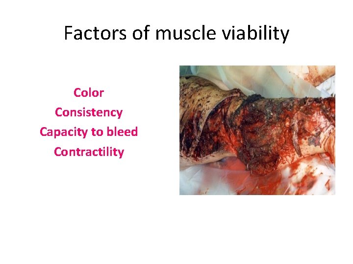 Factors of muscle viability Color Consistency Capacity to bleed Contractility 