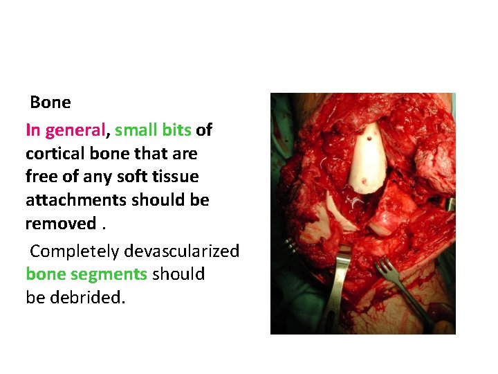 Bone In general, small bits of cortical bone that are free of any soft