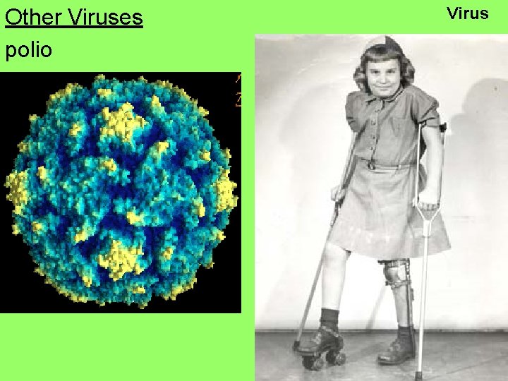 Other Viruses polio Virus 