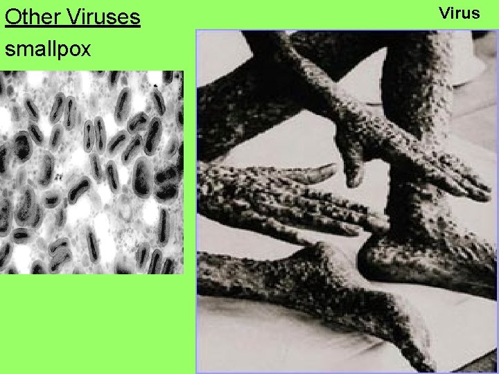 Other Viruses smallpox Virus 