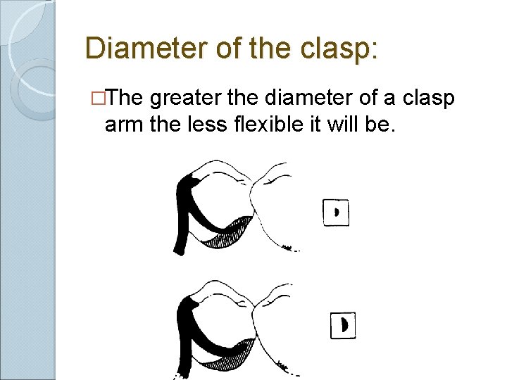 Diameter of the clasp: �The greater the diameter of a clasp arm the less Diameter of the clasp: �The greater the diameter of a clasp arm the less