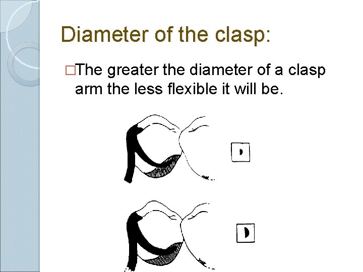 Diameter of the clasp: �The greater the diameter of a clasp arm the less