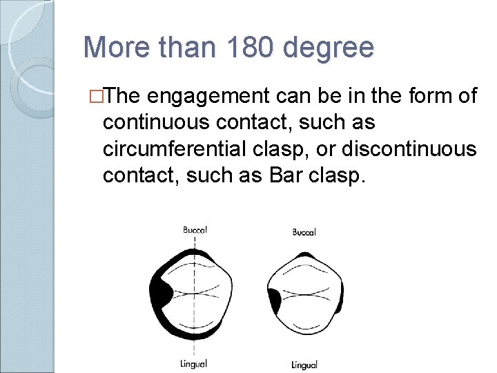 More than 180 degree �The engagement can be in the form of continuous contact,