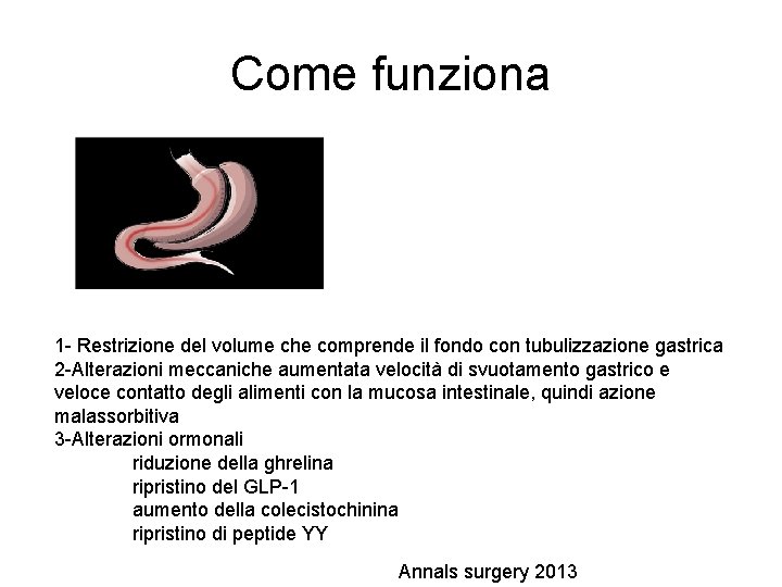 Come funziona 1 - Restrizione del volume che comprende il fondo con tubulizzazione gastrica