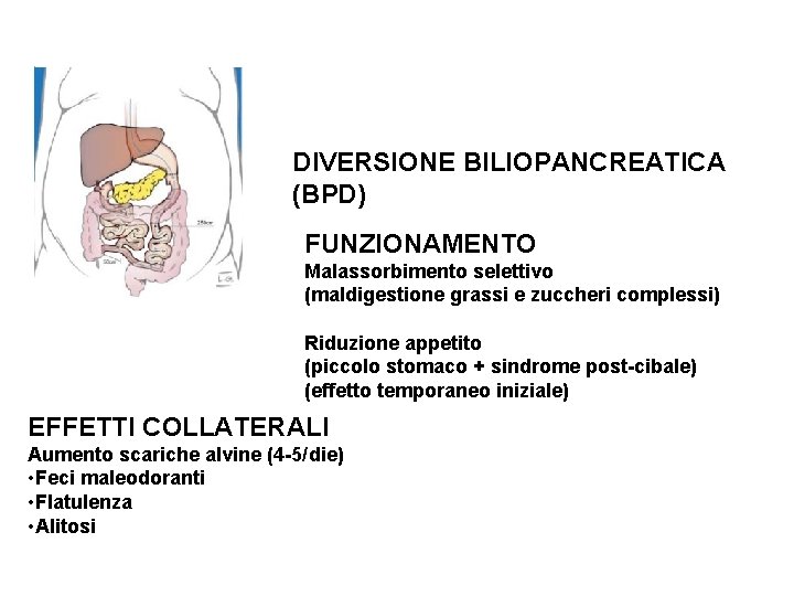 DIVERSIONE BILIOPANCREATICA (BPD) FUNZIONAMENTO Malassorbimento selettivo (maldigestione grassi e zuccheri complessi) Riduzione appetito (piccolo