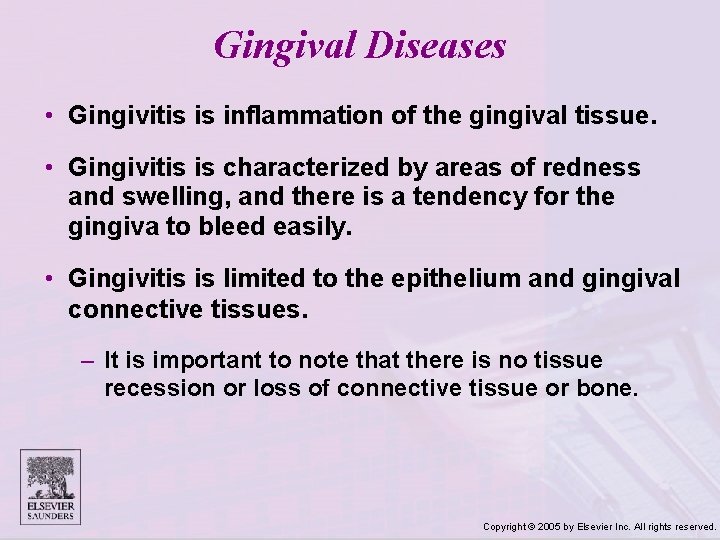 Gingival Diseases • Gingivitis is inflammation of the gingival tissue. • Gingivitis is characterized